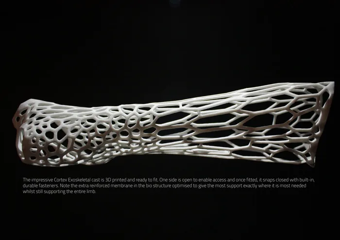 Welcome to the CORTEX Exoskeleton