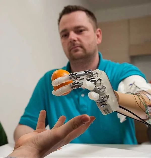 LIFEHAND 2: an excellent prosthetic project from nationally financed project in Italy