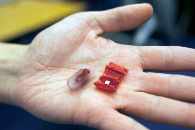 Origami robot: when the cure comes from inside