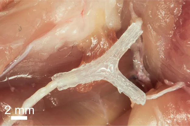 The future of medical 3D printing: Devices with custom geometries and functionalities