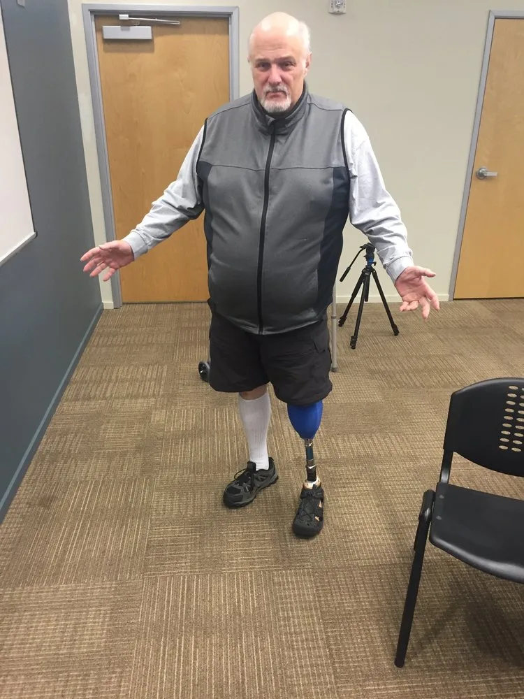 Go Prosthetic: Affordable 3d Printed Limbs for Amputees
