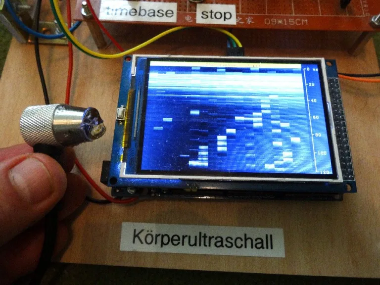 Arduino-Sonography: Arduino-Based  Ultrasound Machine