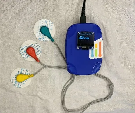 Arduino based ECG (Electrocardiogram) signal analyzer