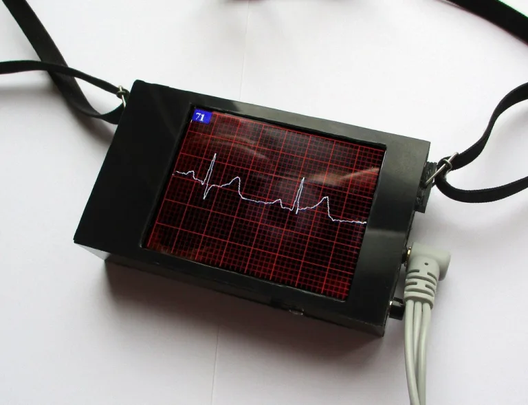 ECG display with Arduino