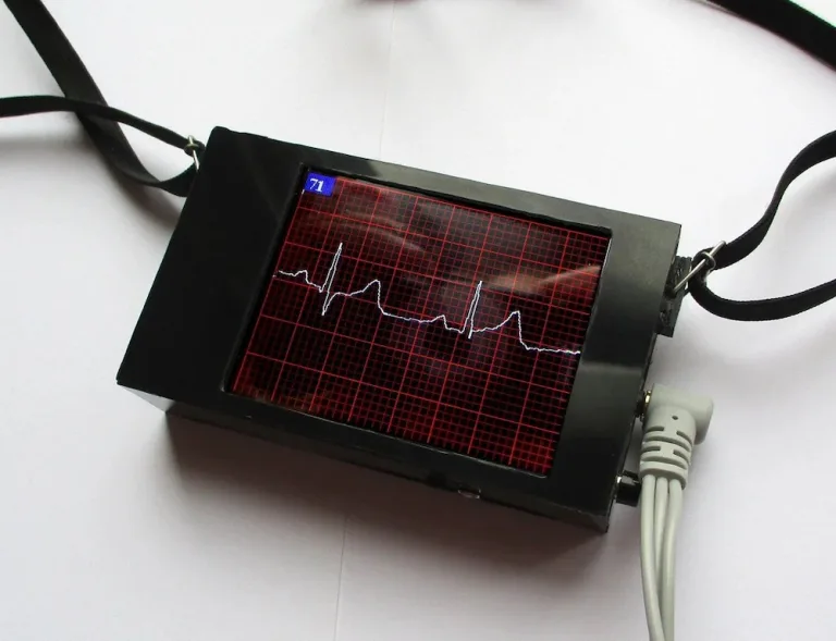 Arduino ecg device